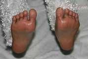 Foot Pics
