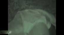 HIDDEN CAM AND FUCKING COUPLES