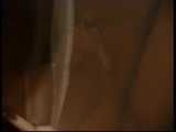 HIDDEN CAM AND FUCKING COUPLES