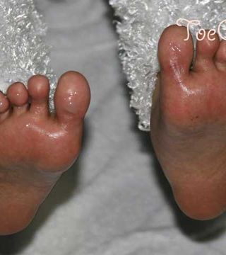 Foot Pics