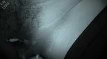 ANONYMOUS HIDDEN FUCK