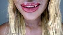 My perfect mouth