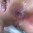 DEEP ANAL OUTDOOR