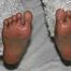 Foot Pics