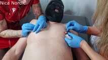 Nippelqual mit Nadeln