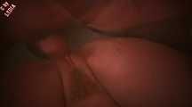 ANAL - DEEP DOES NOT