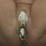 Prickelbrause...