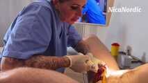 Bizarre und blutige Akupunktur 