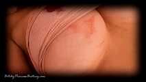 Malpractice