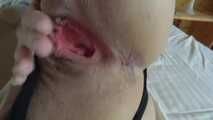 ADRIA ANAL