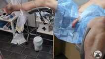 Hanna Engelss - Catheter in and urine out! Short bladder irrigation treatment