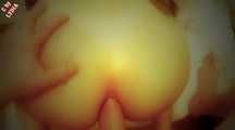 ANAL 26 CM