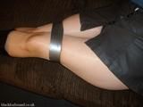 Kathy Taped Up