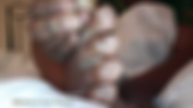 Custom: Ped egg vs thick crusty callouses