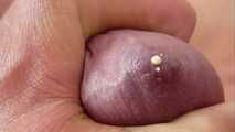 SPERMGIRL