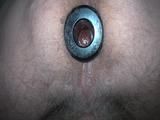 Anal insights