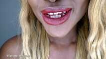 My perfect mouth