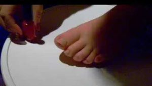Anna's toenails